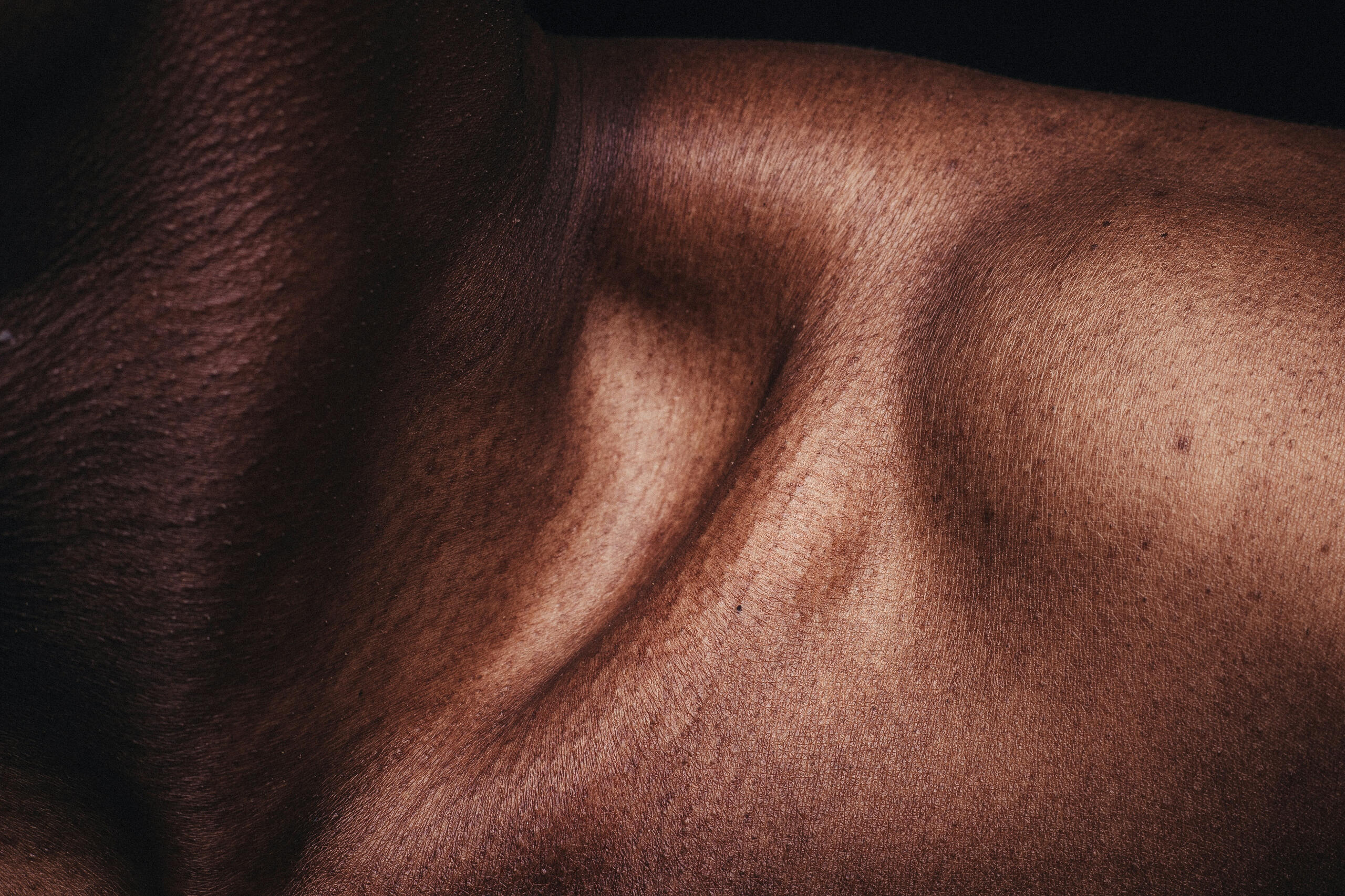 skin